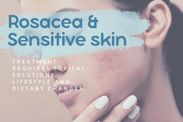 Rosacea and Sensitive Skin